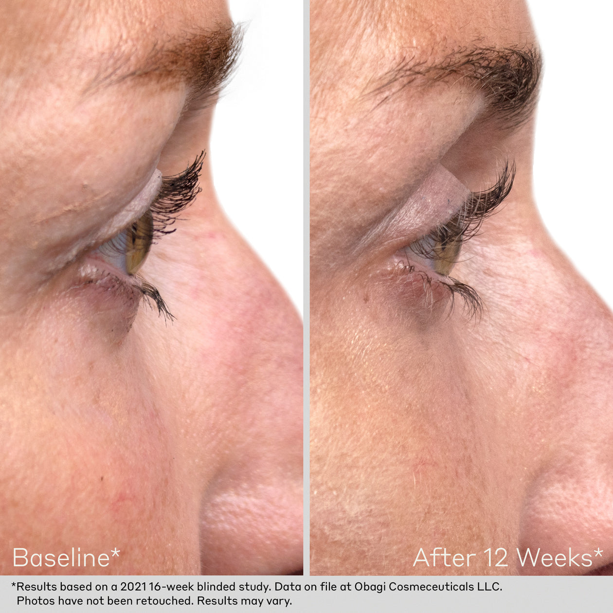 Obagi Nu-Cil Eyelash Serum