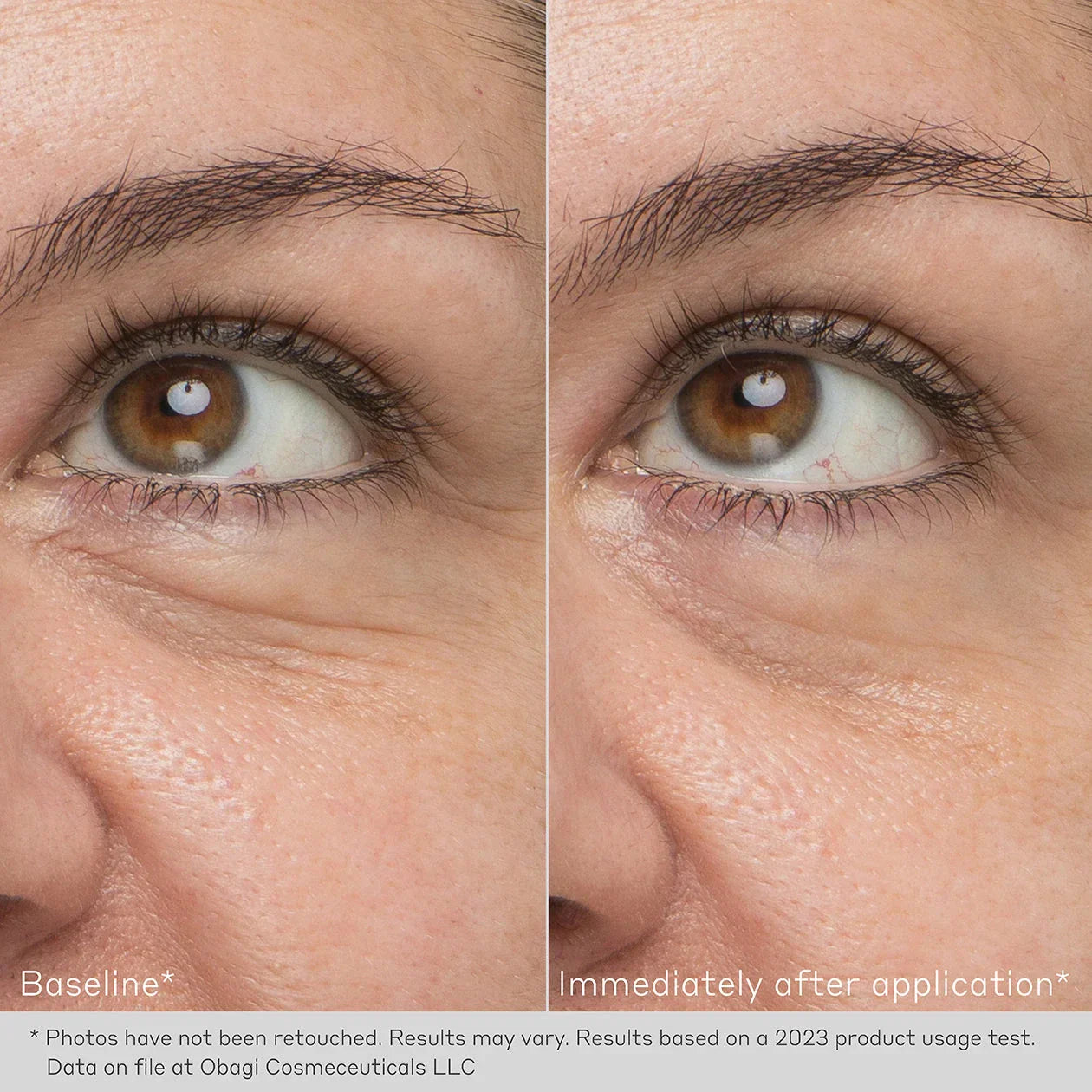 Obagi Hydro-Drops Rejuvenating Eye Gel Cream
